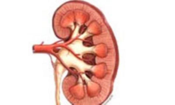 رژیم غذایی ضدسنگ کلیه رژیم غذایی ضدسنگ کلیه