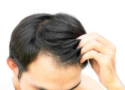 چند ترفند ساده برای جلوگیری از ریزش مو